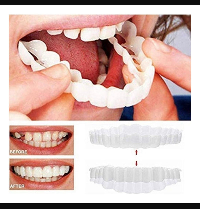 Carillas Dentales Snapon Smile