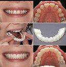 Carillas Dentales Snapon Smile